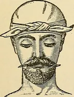 An illustration from Surgical technic; a text-book on operative surgery / by Fr. von Esmarch ... and E. Kowalzig ... translated by Professor Ludwig H. Grau ... and Willam N. Sullivan ... edited by Nicholas Senn ... With fourteen hundred and ninety-seven illustrations and fifteen colored plates. (1901)