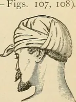 An illustration from Surgical technic; a text-book on operative surgery / by Fr. von Esmarch ... and E. Kowalzig ... translated by Professor Ludwig H. Grau ... and Willam N. Sullivan ... edited by Nicholas Senn ... With fourteen hundred and ninety-seven illustrations and fifteen colored plates. (1901)