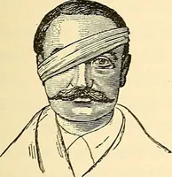 An illustration from Surgical technic; a text-book on operative surgery / by Fr. von Esmarch ... and E. Kowalzig ... translated by Professor Ludwig H. Grau ... and Willam N. Sullivan ... edited by Nicholas Senn ... With fourteen hundred and ninety-seven illustrations and fifteen colored plates. (1901)