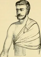 An illustration from Surgical technic; a text-book on operative surgery / by Fr. von Esmarch ... and E. Kowalzig ... translated by Professor Ludwig H. Grau ... and Willam N. Sullivan ... edited by Nicholas Senn ... With fourteen hundred and ninety-seven illustrations and fifteen colored plates. (1901)