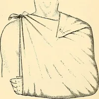 An illustration from Surgical technic; a text-book on operative surgery / by Fr. von Esmarch ... and E. Kowalzig ... translated by Professor Ludwig H. Grau ... and Willam N. Sullivan ... edited by Nicholas Senn ... With fourteen hundred and ninety-seven illustrations and fifteen colored plates. (1901)