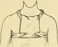 An illustration from Surgical technic; a text-book on operative surgery / by Fr. von Esmarch ... and E. Kowalzig ... translated by Professor Ludwig H. Grau ... and Willam N. Sullivan ... edited by Nicholas Senn ... With fourteen hundred and ninety-seven illustrations and fifteen colored plates. (1901)