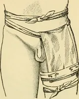 An illustration from Surgical technic; a text-book on operative surgery / by Fr. von Esmarch ... and E. Kowalzig ... translated by Professor Ludwig H. Grau ... and Willam N. Sullivan ... edited by Nicholas Senn ... With fourteen hundred and ninety-seven illustrations and fifteen colored plates. (1901)