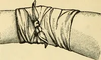 An illustration from Surgical technic; a text-book on operative surgery / by Fr. von Esmarch ... and E. Kowalzig ... translated by Professor Ludwig H. Grau ... and Willam N. Sullivan ... edited by Nicholas Senn ... With fourteen hundred and ninety-seven illustrations and fifteen colored plates. (1901)