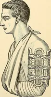 An illustration from Surgical technic; a text-book on operative surgery / by Fr. von Esmarch ... and E. Kowalzig ... translated by Professor Ludwig H. Grau ... and Willam N. Sullivan ... edited by Nicholas Senn ... With fourteen hundred and ninety-seven illustrations and fifteen colored plates. (1901)