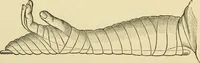 An illustration from Surgical technic; a text-book on operative surgery / by Fr. von Esmarch ... and E. Kowalzig ... translated by Professor Ludwig H. Grau ... and Willam N. Sullivan ... edited by Nicholas Senn ... With fourteen hundred and ninety-seven illustrations and fifteen colored plates. (1901)
