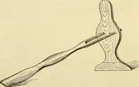 An illustration from Surgical technic; a text-book on operative surgery / by Fr. von Esmarch ... and E. Kowalzig ... translated by Professor Ludwig H. Grau ... and Willam N. Sullivan ... edited by Nicholas Senn ... With fourteen hundred and ninety-seven illustrations and fifteen colored plates. (1901)