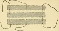 An illustration from Surgical technic; a text-book on operative surgery / by Fr. von Esmarch ... and E. Kowalzig ... translated by Professor Ludwig H. Grau ... and Willam N. Sullivan ... edited by Nicholas Senn ... With fourteen hundred and ninety-seven illustrations and fifteen colored plates. (1901)