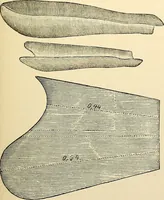 An illustration from Surgical technic; a text-book on operative surgery / by Fr. von Esmarch ... and E. Kowalzig ... translated by Professor Ludwig H. Grau ... and Willam N. Sullivan ... edited by Nicholas Senn ... With fourteen hundred and ninety-seven illustrations and fifteen colored plates. (1901)