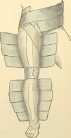 An illustration from Surgical technic; a text-book on operative surgery / by Fr. von Esmarch ... and E. Kowalzig ... translated by Professor Ludwig H. Grau ... and Willam N. Sullivan ... edited by Nicholas Senn ... With fourteen hundred and ninety-seven illustrations and fifteen colored plates. (1901)