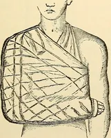 An illustration from Surgical technic; a text-book on operative surgery / by Fr. von Esmarch ... and E. Kowalzig ... translated by Professor Ludwig H. Grau ... and Willam N. Sullivan ... edited by Nicholas Senn ... With fourteen hundred and ninety-seven illustrations and fifteen colored plates. (1901)