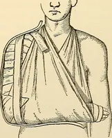 An illustration from Surgical technic; a text-book on operative surgery / by Fr. von Esmarch ... and E. Kowalzig ... translated by Professor Ludwig H. Grau ... and Willam N. Sullivan ... edited by Nicholas Senn ... With fourteen hundred and ninety-seven illustrations and fifteen colored plates. (1901)