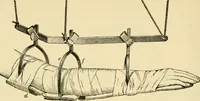 An illustration from Surgical technic; a text-book on operative surgery / by Fr. von Esmarch ... and E. Kowalzig ... translated by Professor Ludwig H. Grau ... and Willam N. Sullivan ... edited by Nicholas Senn ... With fourteen hundred and ninety-seven illustrations and fifteen colored plates. (1901)