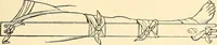 An illustration from Surgical technic; a text-book on operative surgery / by Fr. von Esmarch ... and E. Kowalzig ... translated by Professor Ludwig H. Grau ... and Willam N. Sullivan ... edited by Nicholas Senn ... With fourteen hundred and ninety-seven illustrations and fifteen colored plates. (1901)