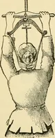 An illustration from Surgical technic; a text-book on operative surgery / by Fr. von Esmarch ... and E. Kowalzig ... translated by Professor Ludwig H. Grau ... and Willam N. Sullivan ... edited by Nicholas Senn ... With fourteen hundred and ninety-seven illustrations and fifteen colored plates. (1901)