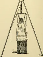 An illustration from Surgical technic; a text-book on operative surgery / by Fr. von Esmarch ... and E. Kowalzig ... translated by Professor Ludwig H. Grau ... and Willam N. Sullivan ... edited by Nicholas Senn ... With fourteen hundred and ninety-seven illustrations and fifteen colored plates. (1901)
