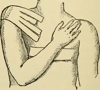 An illustration from Surgical technic; a text-book on operative surgery / by Fr. von Esmarch ... and E. Kowalzig ... translated by Professor Ludwig H. Grau ... and Willam N. Sullivan ... edited by Nicholas Senn ... With fourteen hundred and ninety-seven illustrations and fifteen colored plates. (1901)