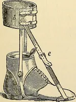 An illustration from Surgical technic; a text-book on operative surgery / by Fr. von Esmarch ... and E. Kowalzig ... translated by Professor Ludwig H. Grau ... and Willam N. Sullivan ... edited by Nicholas Senn ... With fourteen hundred and ninety-seven illustrations and fifteen colored plates. (1901)