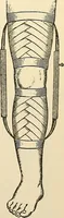 An illustration from Surgical technic; a text-book on operative surgery / by Fr. von Esmarch ... and E. Kowalzig ... translated by Professor Ludwig H. Grau ... and Willam N. Sullivan ... edited by Nicholas Senn ... With fourteen hundred and ninety-seven illustrations and fifteen colored plates. (1901)