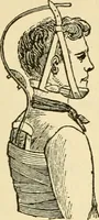 An illustration from Surgical technic; a text-book on operative surgery / by Fr. von Esmarch ... and E. Kowalzig ... translated by Professor Ludwig H. Grau ... and Willam N. Sullivan ... edited by Nicholas Senn ... With fourteen hundred and ninety-seven illustrations and fifteen colored plates. (1901)