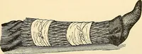An illustration from Surgical technic; a text-book on operative surgery / by Fr. von Esmarch ... and E. Kowalzig ... translated by Professor Ludwig H. Grau ... and Willam N. Sullivan ... edited by Nicholas Senn ... With fourteen hundred and ninety-seven illustrations and fifteen colored plates. (1901)