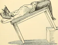 An illustration from Surgical technic; a text-book on operative surgery / by Fr. von Esmarch ... and E. Kowalzig ... translated by Professor Ludwig H. Grau ... and Willam N. Sullivan ... edited by Nicholas Senn ... With fourteen hundred and ninety-seven illustrations and fifteen colored plates. (1901)