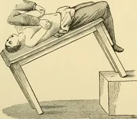 An illustration from Surgical technic; a text-book on operative surgery / by Fr. von Esmarch ... and E. Kowalzig ... translated by Professor Ludwig H. Grau ... and Willam N. Sullivan ... edited by Nicholas Senn ... With fourteen hundred and ninety-seven illustrations and fifteen colored plates. (1901)
