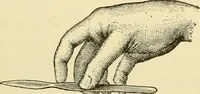 An illustration from Surgical technic; a text-book on operative surgery / by Fr. von Esmarch ... and E. Kowalzig ... translated by Professor Ludwig H. Grau ... and Willam N. Sullivan ... edited by Nicholas Senn ... With fourteen hundred and ninety-seven illustrations and fifteen colored plates. (1901)