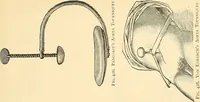 An illustration from Surgical technic; a text-book on operative surgery / by Fr. von Esmarch ... and E. Kowalzig ... translated by Professor Ludwig H. Grau ... and Willam N. Sullivan ... edited by Nicholas Senn ... With fourteen hundred and ninety-seven illustrations and fifteen colored plates. (1901)