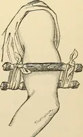 An illustration from Surgical technic; a text-book on operative surgery / by Fr. von Esmarch ... and E. Kowalzig ... translated by Professor Ludwig H. Grau ... and Willam N. Sullivan ... edited by Nicholas Senn ... With fourteen hundred and ninety-seven illustrations and fifteen colored plates. (1901)
