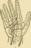 An illustration from Surgical technic; a text-book on operative surgery / by Fr. von Esmarch ... and E. Kowalzig ... translated by Professor Ludwig H. Grau ... and Willam N. Sullivan ... edited by Nicholas Senn ... With fourteen hundred and ninety-seven illustrations and fifteen colored plates. (1901)
