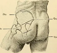 An illustration from Surgical technic; a text-book on operative surgery / by Fr. von Esmarch ... and E. Kowalzig ... translated by Professor Ludwig H. Grau ... and Willam N. Sullivan ... edited by Nicholas Senn ... With fourteen hundred and ninety-seven illustrations and fifteen colored plates. (1901)
