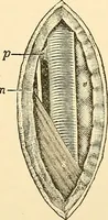 An illustration from Surgical technic; a text-book on operative surgery / by Fr. von Esmarch ... and E. Kowalzig ... translated by Professor Ludwig H. Grau ... and Willam N. Sullivan ... edited by Nicholas Senn ... With fourteen hundred and ninety-seven illustrations and fifteen colored plates. (1901)