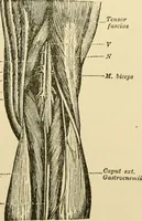 An illustration from Surgical technic; a text-book on operative surgery / by Fr. von Esmarch ... and E. Kowalzig ... translated by Professor Ludwig H. Grau ... and Willam N. Sullivan ... edited by Nicholas Senn ... With fourteen hundred and ninety-seven illustrations and fifteen colored plates. (1901)