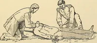 An illustration from Surgical technic; a text-book on operative surgery / by Fr. von Esmarch ... and E. Kowalzig ... translated by Professor Ludwig H. Grau ... and Willam N. Sullivan ... edited by Nicholas Senn ... With fourteen hundred and ninety-seven illustrations and fifteen colored plates. (1901)