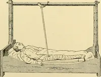 An illustration from Surgical technic; a text-book on operative surgery / by Fr. von Esmarch ... and E. Kowalzig ... translated by Professor Ludwig H. Grau ... and Willam N. Sullivan ... edited by Nicholas Senn ... With fourteen hundred and ninety-seven illustrations and fifteen colored plates. (1901)