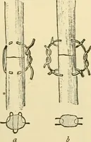 An illustration from Surgical technic; a text-book on operative surgery / by Fr. von Esmarch ... and E. Kowalzig ... translated by Professor Ludwig H. Grau ... and Willam N. Sullivan ... edited by Nicholas Senn ... With fourteen hundred and ninety-seven illustrations and fifteen colored plates. (1901)
