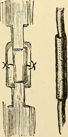 An illustration from Surgical technic; a text-book on operative surgery / by Fr. von Esmarch ... and E. Kowalzig ... translated by Professor Ludwig H. Grau ... and Willam N. Sullivan ... edited by Nicholas Senn ... With fourteen hundred and ninety-seven illustrations and fifteen colored plates. (1901)