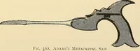 An illustration from Surgical technic; a text-book on operative surgery / by Fr. von Esmarch ... and E. Kowalzig ... translated by Professor Ludwig H. Grau ... and Willam N. Sullivan ... edited by Nicholas Senn ... With fourteen hundred and ninety-seven illustrations and fifteen colored plates. (1901)