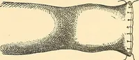 An illustration from Surgical technic; a text-book on operative surgery / by Fr. von Esmarch ... and E. Kowalzig ... translated by Professor Ludwig H. Grau ... and Willam N. Sullivan ... edited by Nicholas Senn ... With fourteen hundred and ninety-seven illustrations and fifteen colored plates. (1901)