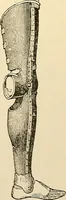 An illustration from Surgical technic; a text-book on operative surgery / by Fr. von Esmarch ... and E. Kowalzig ... translated by Professor Ludwig H. Grau ... and Willam N. Sullivan ... edited by Nicholas Senn ... With fourteen hundred and ninety-seven illustrations and fifteen colored plates. (1901)