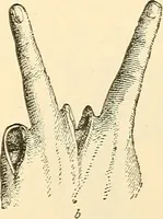 An illustration from Surgical technic; a text-book on operative surgery / by Fr. von Esmarch ... and E. Kowalzig ... translated by Professor Ludwig H. Grau ... and Willam N. Sullivan ... edited by Nicholas Senn ... With fourteen hundred and ninety-seven illustrations and fifteen colored plates. (1901)