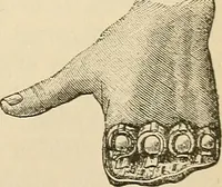 An illustration from Surgical technic; a text-book on operative surgery / by Fr. von Esmarch ... and E. Kowalzig ... translated by Professor Ludwig H. Grau ... and Willam N. Sullivan ... edited by Nicholas Senn ... With fourteen hundred and ninety-seven illustrations and fifteen colored plates. (1901)