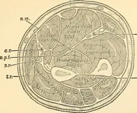 An illustration from Surgical technic; a text-book on operative surgery / by Fr. von Esmarch ... and E. Kowalzig ... translated by Professor Ludwig H. Grau ... and Willam N. Sullivan ... edited by Nicholas Senn ... With fourteen hundred and ninety-seven illustrations and fifteen colored plates. (1901)
