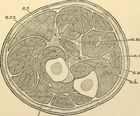 An illustration from Surgical technic; a text-book on operative surgery / by Fr. von Esmarch ... and E. Kowalzig ... translated by Professor Ludwig H. Grau ... and Willam N. Sullivan ... edited by Nicholas Senn ... With fourteen hundred and ninety-seven illustrations and fifteen colored plates. (1901)
