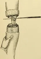 An illustration from Surgical technic; a text-book on operative surgery / by Fr. von Esmarch ... and E. Kowalzig ... translated by Professor Ludwig H. Grau ... and Willam N. Sullivan ... edited by Nicholas Senn ... With fourteen hundred and ninety-seven illustrations and fifteen colored plates. (1901)