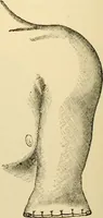 An illustration from Surgical technic; a text-book on operative surgery / by Fr. von Esmarch ... and E. Kowalzig ... translated by Professor Ludwig H. Grau ... and Willam N. Sullivan ... edited by Nicholas Senn ... With fourteen hundred and ninety-seven illustrations and fifteen colored plates. (1901)