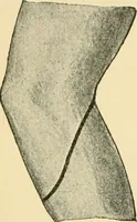 An illustration from Surgical technic; a text-book on operative surgery / by Fr. von Esmarch ... and E. Kowalzig ... translated by Professor Ludwig H. Grau ... and Willam N. Sullivan ... edited by Nicholas Senn ... With fourteen hundred and ninety-seven illustrations and fifteen colored plates. (1901)
