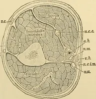 An illustration from Surgical technic; a text-book on operative surgery / by Fr. von Esmarch ... and E. Kowalzig ... translated by Professor Ludwig H. Grau ... and Willam N. Sullivan ... edited by Nicholas Senn ... With fourteen hundred and ninety-seven illustrations and fifteen colored plates. (1901)