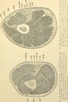 An illustration from Surgical technic; a text-book on operative surgery / by Fr. von Esmarch ... and E. Kowalzig ... translated by Professor Ludwig H. Grau ... and Willam N. Sullivan ... edited by Nicholas Senn ... With fourteen hundred and ninety-seven illustrations and fifteen colored plates. (1901)